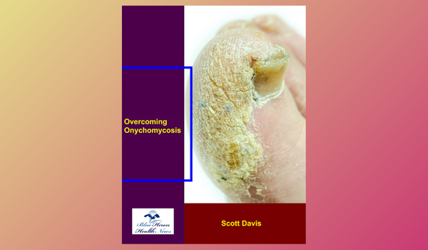 Overcoming Onychomycosis Reviews.