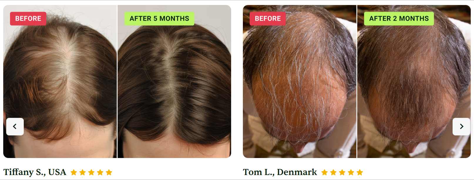HaloGrow Hair Spray results